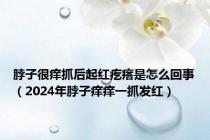 脖子很痒抓后起红疙瘩是怎么回事（2024年脖子痒痒一抓发红）