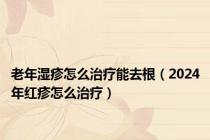 老年湿疹怎么治疗能去根（2024年红疹怎么治疗）