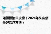 如何根治头皮癣（2024年头皮癣最好治疗方法）