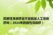 抓痕性荨麻疹是不是就是人工荨麻疹吗（2024年抓痕性荨麻疹）