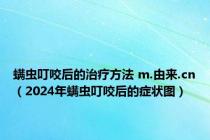 螨虫叮咬后的治疗方法 m.由来.cn（2024年螨虫叮咬后的症状图）