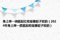 身上痒一挠就起红疙瘩像蚊子咬的（2024年身上痒一抓就起疙瘩像蚊子咬的）