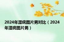 2024年湿疣图片男对比（2024年湿疣图片男）