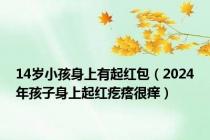 14岁小孩身上有起红包（2024年孩子身上起红疙瘩很痒）