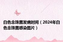 白色念珠菌发病时间（2024年白色念珠菌感染图片）