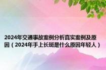 2024年交通事故案例分析真实案例及原因（2024年手上长斑是什么原因年轻人）