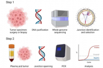 检测复杂 DNA 模式的创新测试可能会提高血液中间皮瘤的检测率